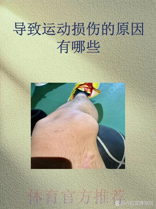 预计伤缺2个月!阿诺德左腿股四头肌前直肌受伤 预计伤缺2个月!阿诺德左腿股四头肌前直肌受伤
